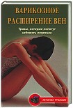 Читати книгу Варикозное расширение вен. Травы, которые помогут избежать операции